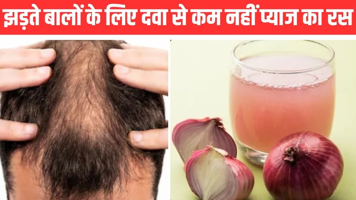 Onion Juice Benefits for Hair