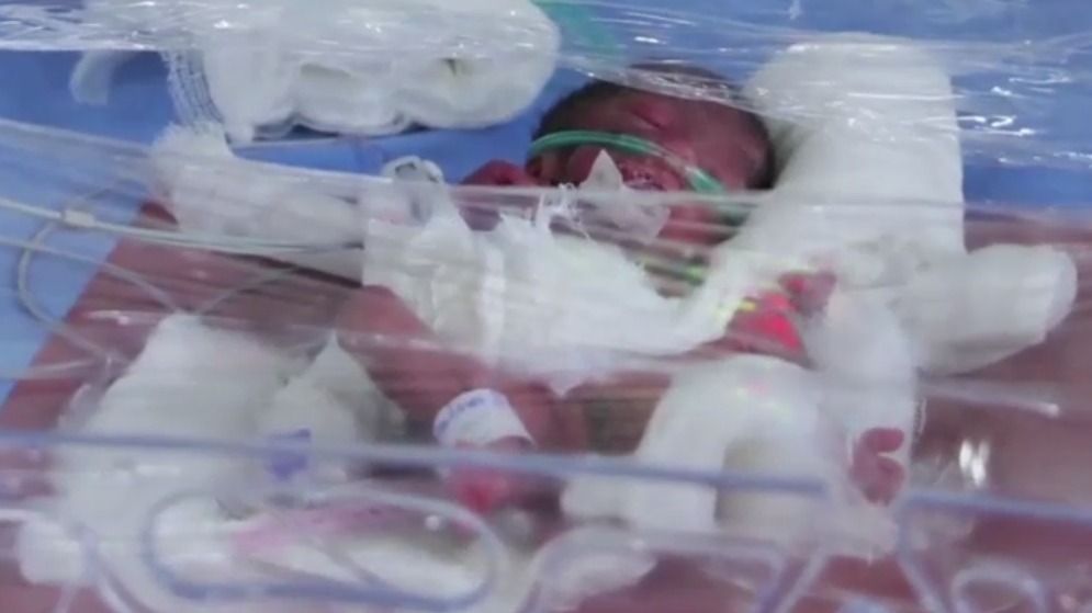 Woman gives birth to four children