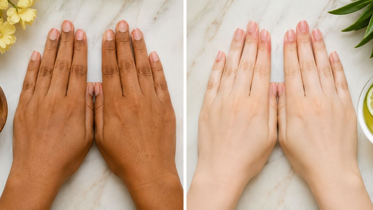 Tanning Of Hands