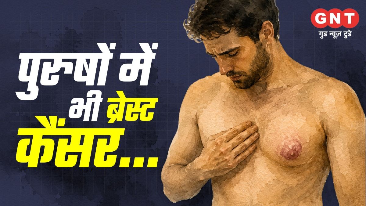 Male Breast Cancer