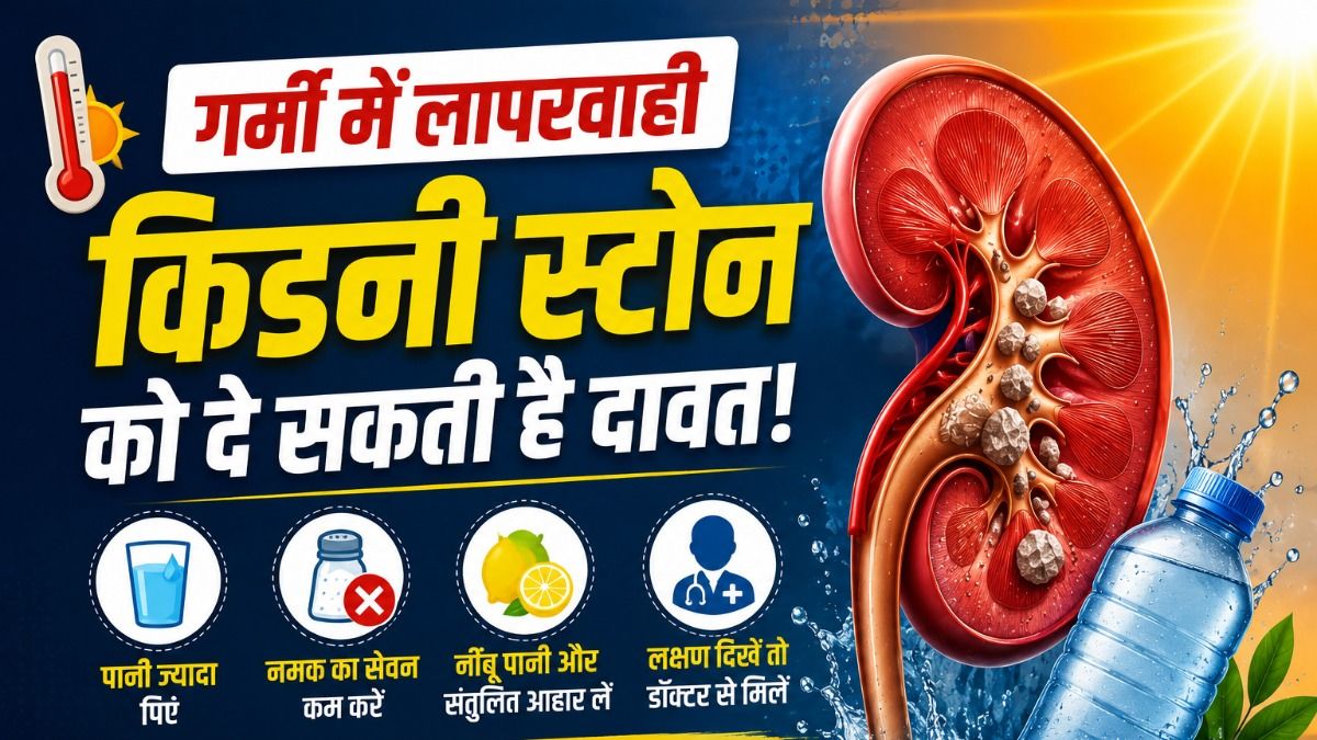 Does the Risk of Kidney Stones Increase During Summer