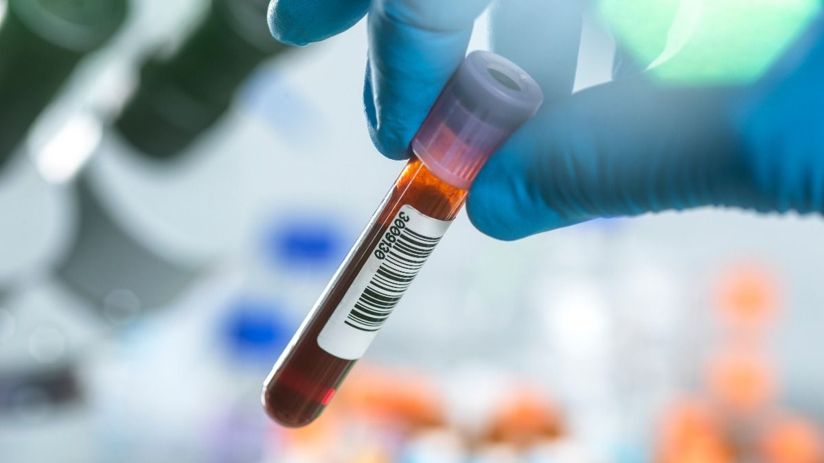 Blood Test