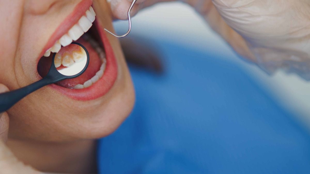 teeth