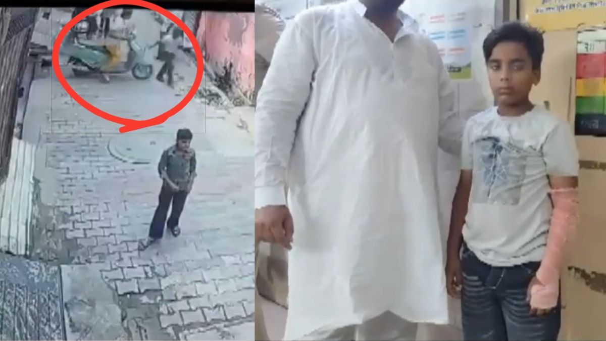 घायल बच्चा