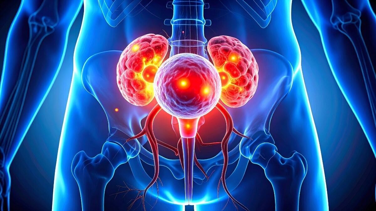 Prostate Cancer Treatment