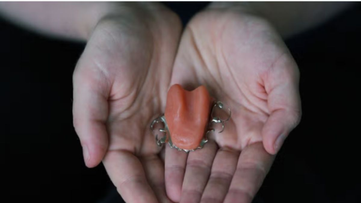 Silicone tongue on U-shaped frame made of cobalt chrome(Image: Yui Mok/PA Wire