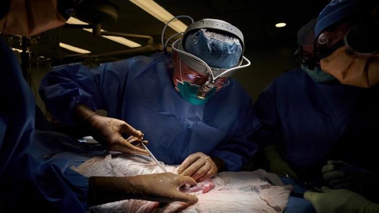 surgeons attached a pig kidney to a human