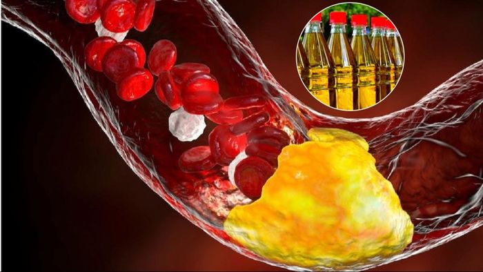 কোলেস্টেরল কমাতে উপকারী তেল