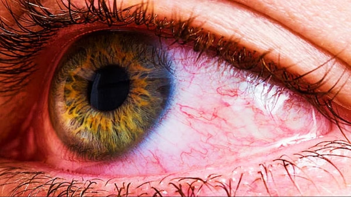 চোখে ঝাপসা দেখছেন? ডায়াবিটিস নয় তো! চোখে ঝাপসা দেখছেন? ডায়াবিটিস নয় তো!