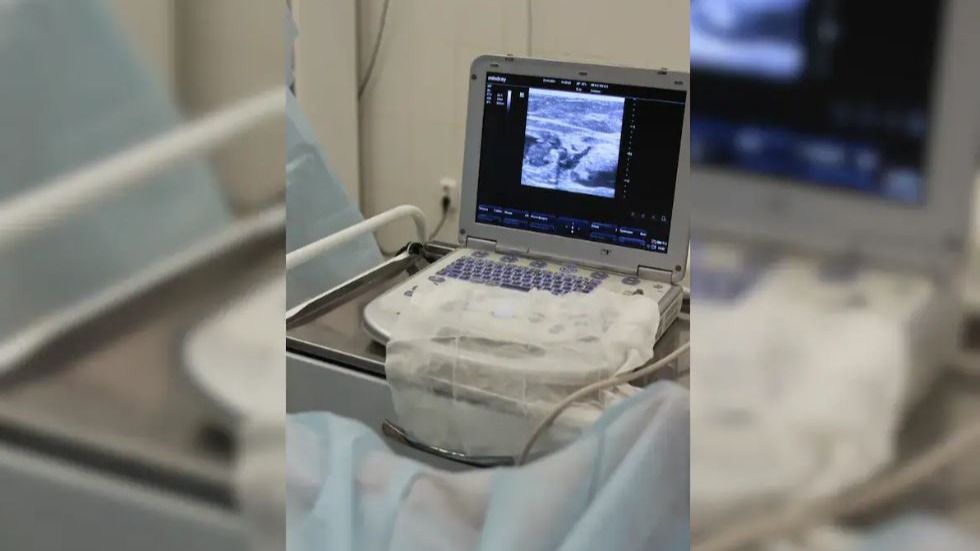 Ultrasound Ultrasound