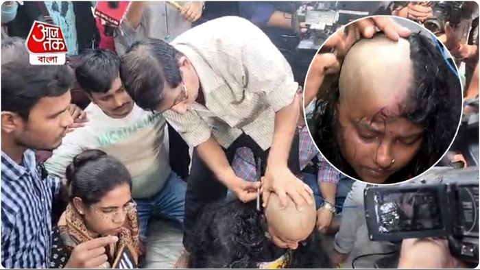 ধর্নায় পথে ১০০০ দিন, প্রতিবাদে মাথা ন্যাড়া করালেন SLST চাকরিপ্রার্থী!