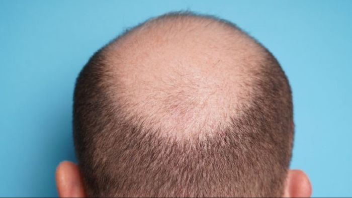 প্রতীকী চিত্র।