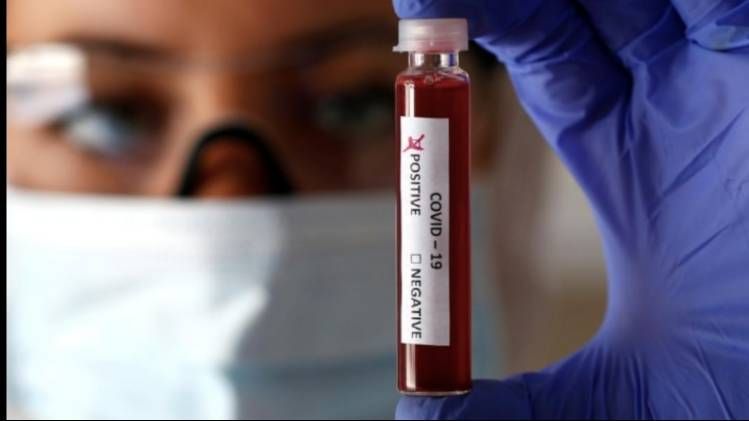 प्रतिनिधि तस्वीर 