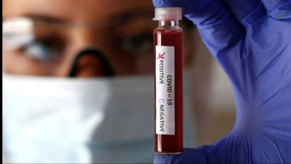 प्रतिनिधि तस्वीर