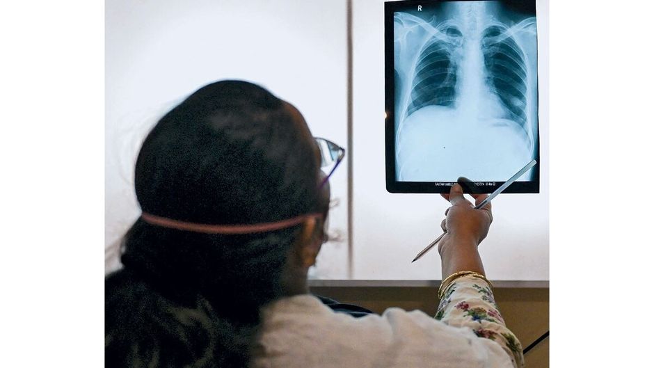 मुंबई के मेडिसिन्स सैंस फ्रंटियर्स की क्लिनिक में एक टीबी मरीज के एक्स-रे की जांच करती डॉक्टर