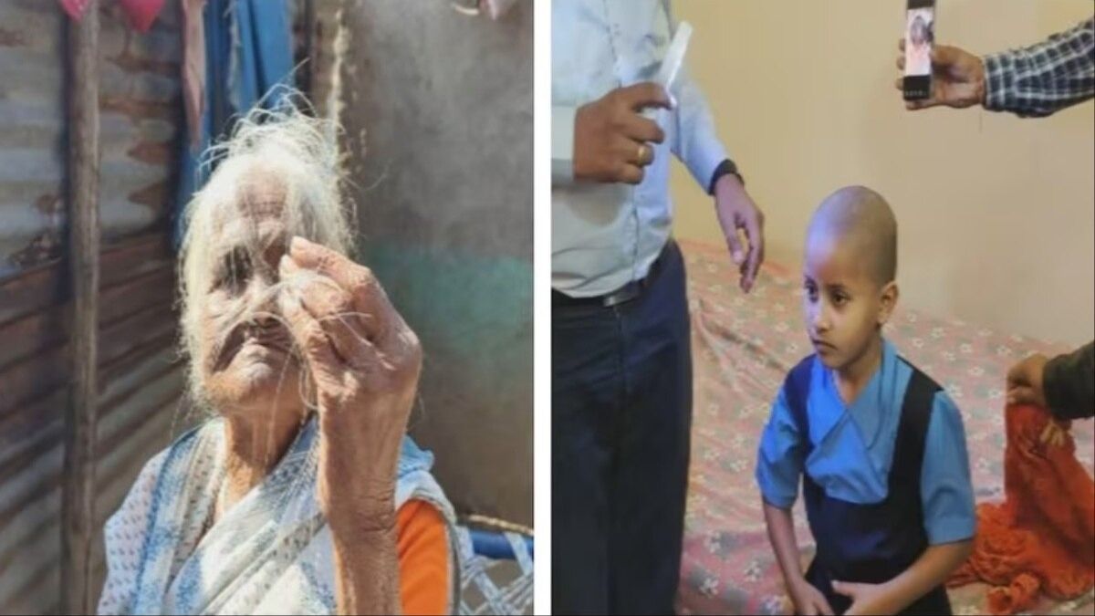 क्या बच्चे और क्या बूढ़े, सभी इस अचानक गंजेपन की समस्या से पीड़ित हैं