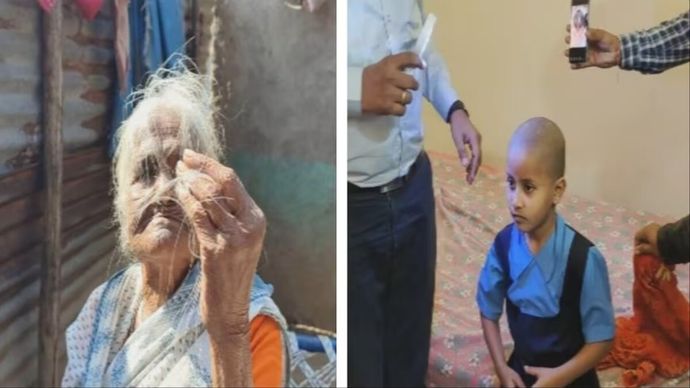 क्या बच्चे और क्या बूढ़े, सभी इस अचानक गंजेपन की समस्या से पीड़ित हैं