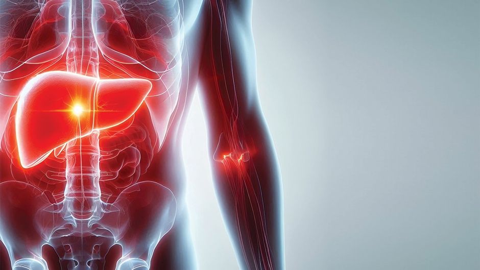 जानलेवा नॉन-अल्कोहलिक फैटी लिवर बीमारी देश में महामारी जैसी विकराल हुई