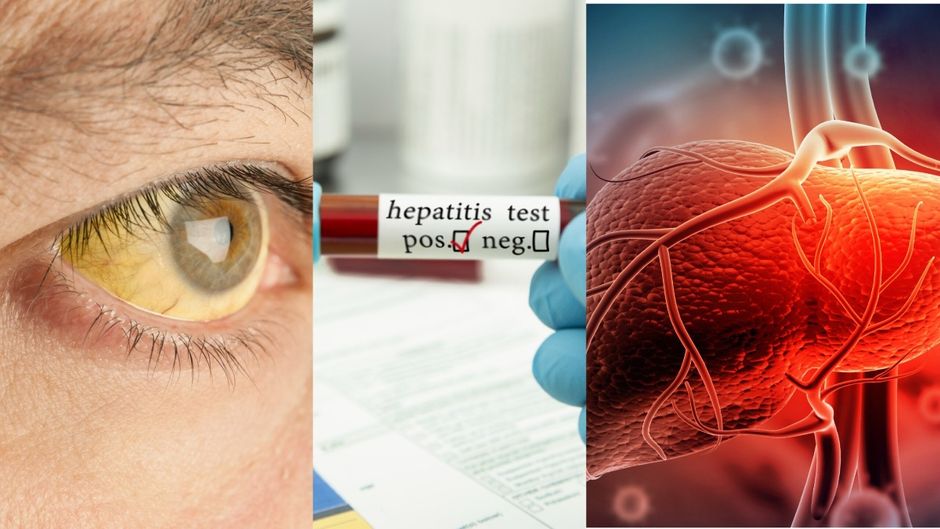 सांकेतिक तस्वीर