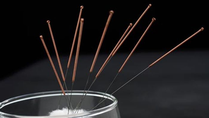 Visual representation of Acupuncture