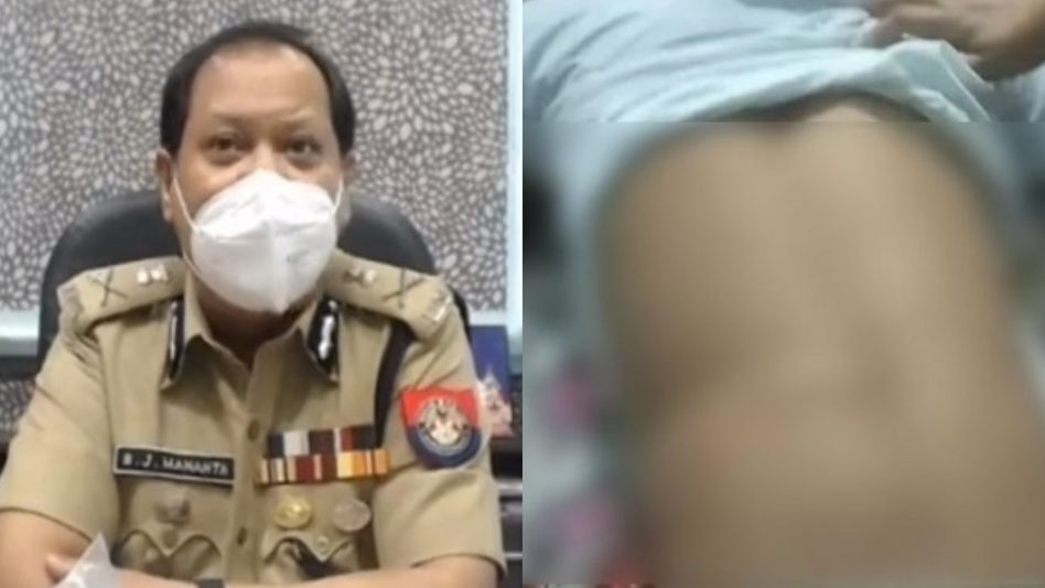 Assam police offer lollipop of excuses after beating a specially-abled kid Assam police offer lollipop of excuses after beating a specially-abled kid
