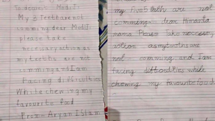 Assam siblings write to PM Modi & CM after losing baby teeth, demands ‘urgent action’