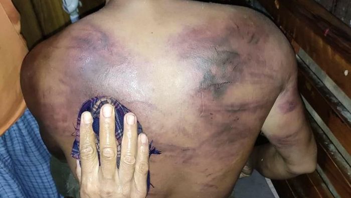 Khongsai Youth Union beaten