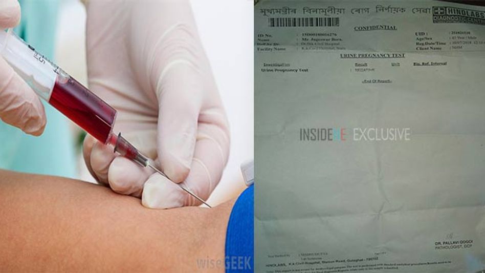Assam: Man goes for urine test, handed pregnancy report by hospital Assam: Man goes for urine test, handed pregnancy report by hospital