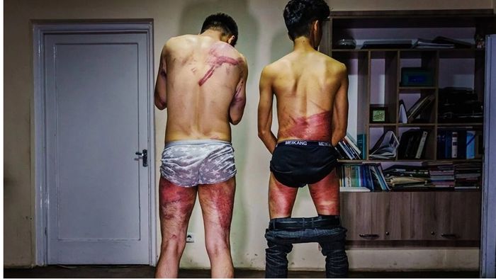 Taliban brutally thrash journalists for covering women's protest; pictures go viral