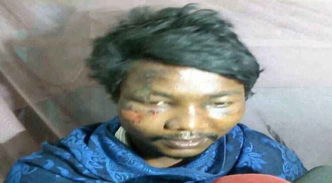 MAN SETS HIS WIFE ON FIRE