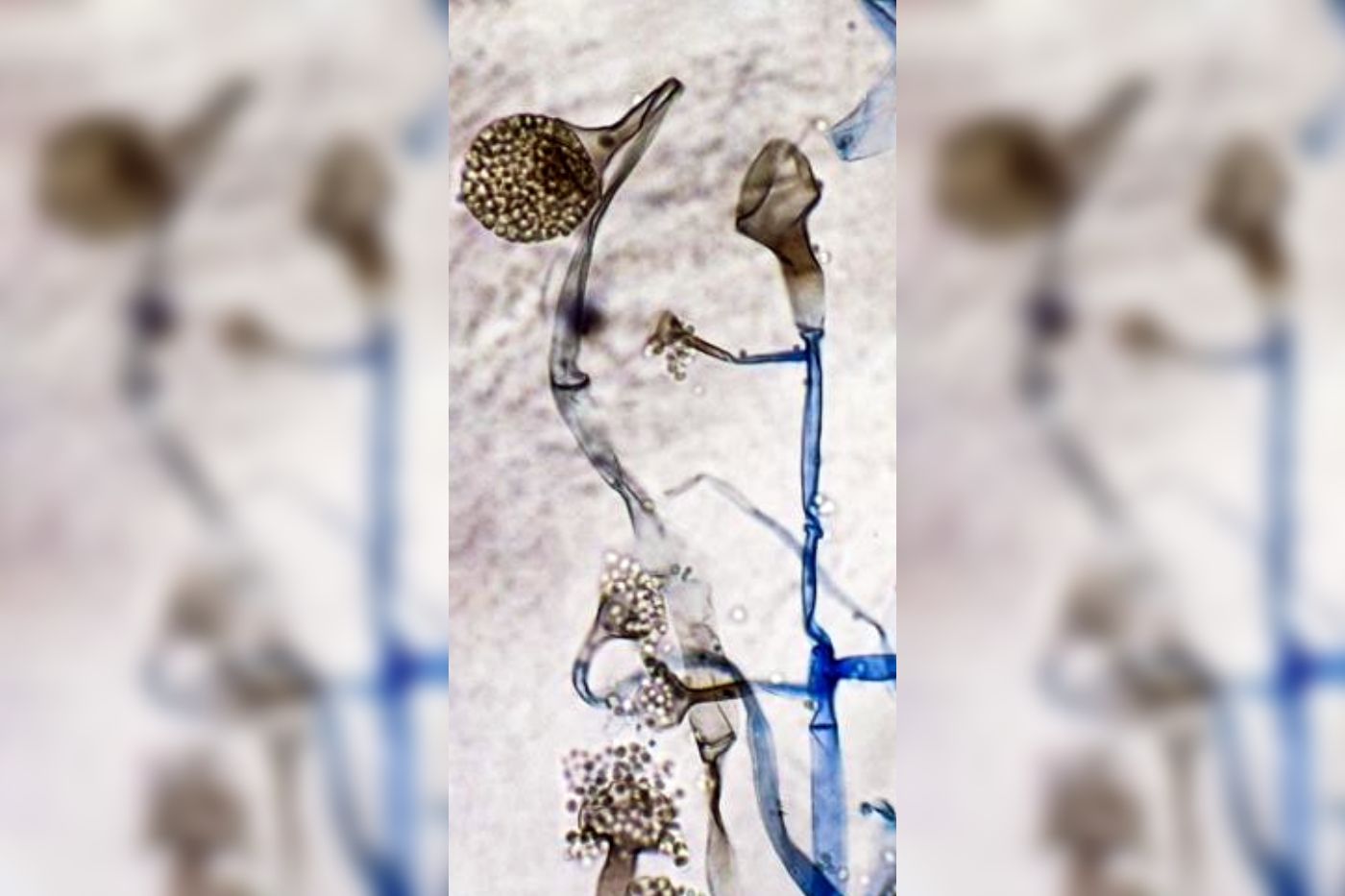 Black Fungus declared an epidemic in Nagaland fearing spread of the disease Black Fungus declared an epidemic in Nagaland fearing spread of the disease