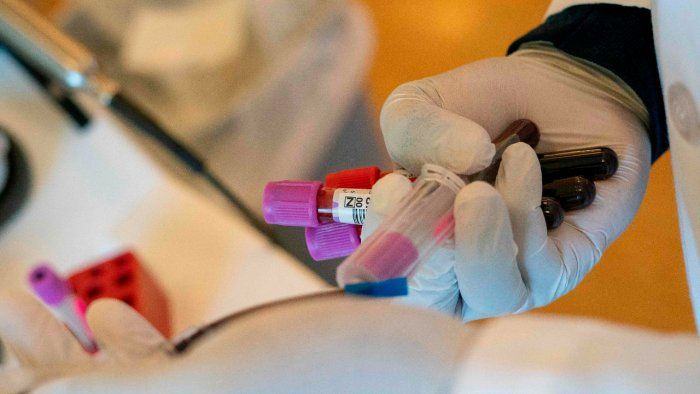 Plasma therapy