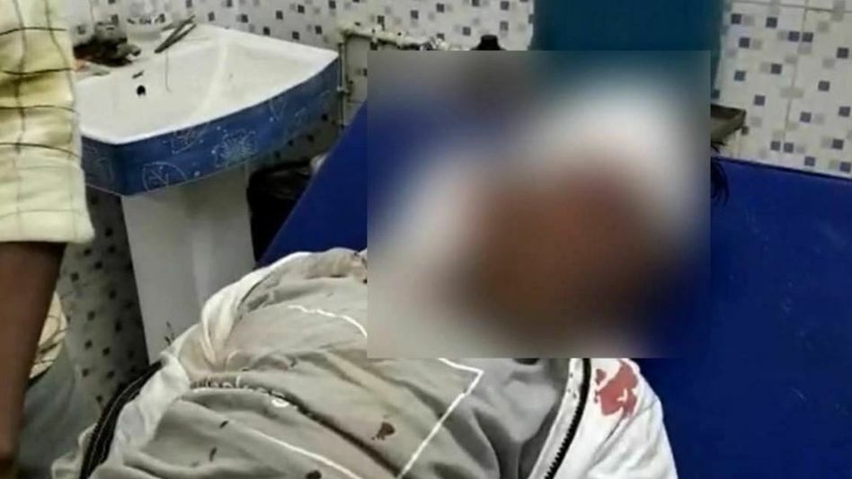 Sahdev Dirdo involved in serious motorcycle accident; shifted to hospital Sahdev Dirdo involved in serious motorcycle accident; shifted to hospital