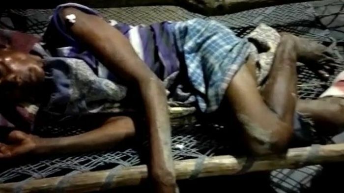 One injured in elephant attack