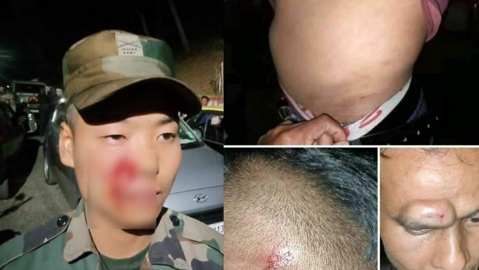 Army civilian clash Shillong