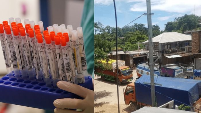 Mizoram hit by shortage of testing reagents