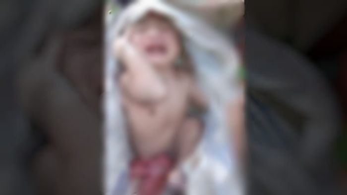 Baby born without urinal tube in Assam