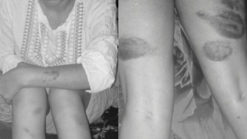 Assam Police accused of torturing a Garo woman in Goalpara Assam Police accused of torturing a Garo woman in Goalpara