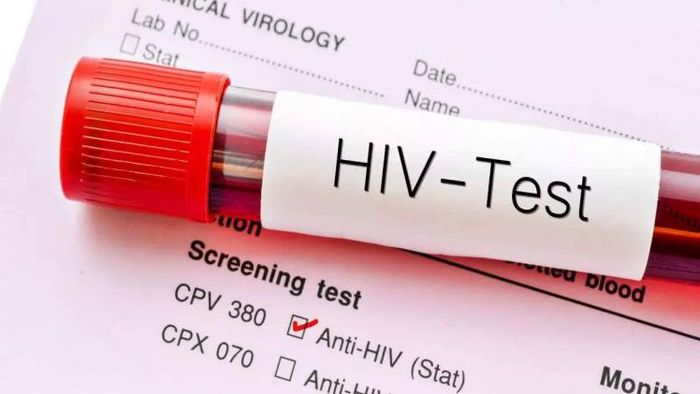 HIV cases quadruple in Guwahati, latest report shows 7,610 cases registered till date
