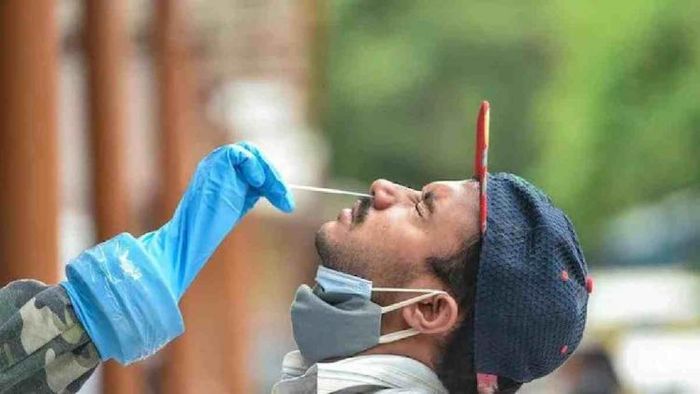 Representative Image