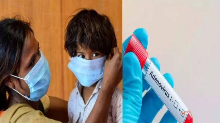 Spike in Adenovirus cases among children in Kolkata alarms health officials