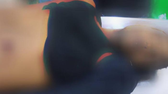 Assam: Dibrugarh police shoot and kill robber attempting to flee