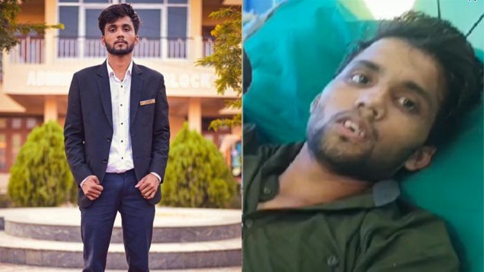 Dibrugarh ragging case victim Anand Sharma discharged from hospital