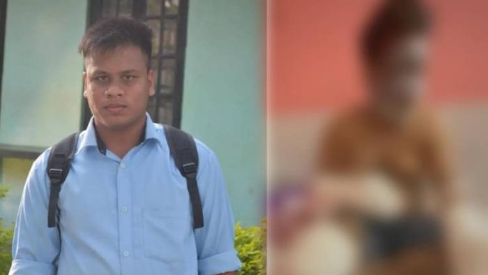 Assam: Student injured in practical class at Technical Industrial Training Institute in Tinsukia