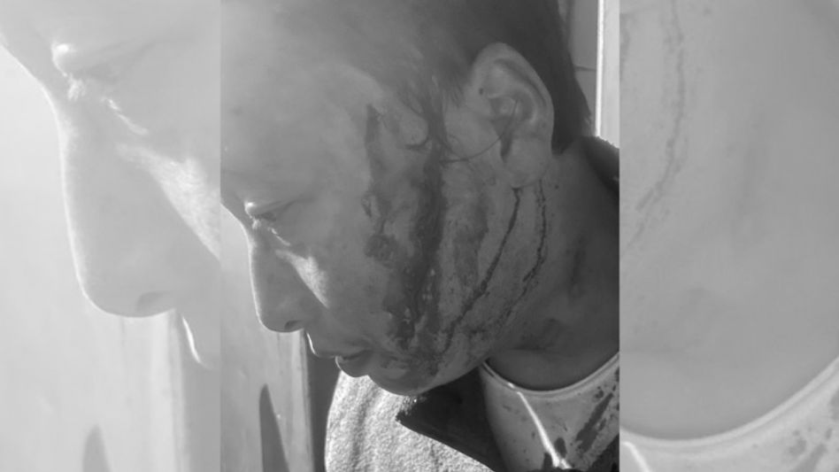 Sikkim: Sadar police arrest four in SDF general secretary attack case Sikkim: Sadar police arrest four in SDF general secretary attack case