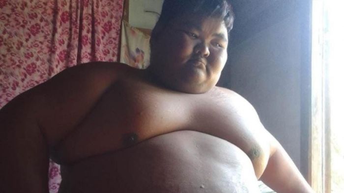 Mizoram's most obese man dies at the age of 27