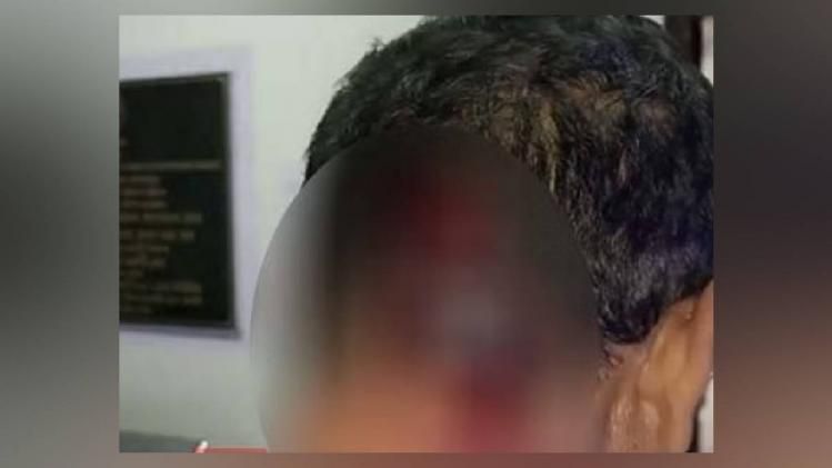 The injured police showing his injuries