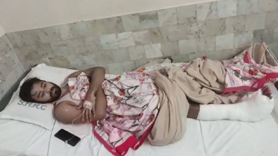 Assam: Union minister Rameshwar Teli’s convoy hits biker in Dibrugarh, critically injured Assam: Union minister Rameshwar Teli’s convoy hits biker in Dibrugarh, critically injured