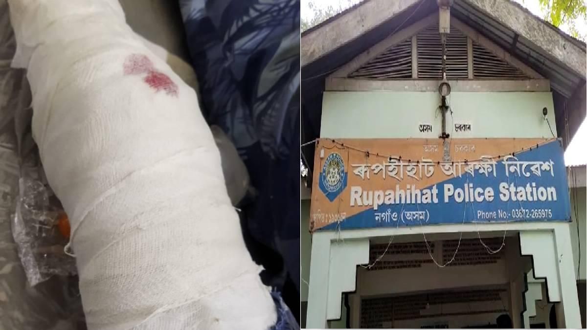 Drugs peddler injured in police firing