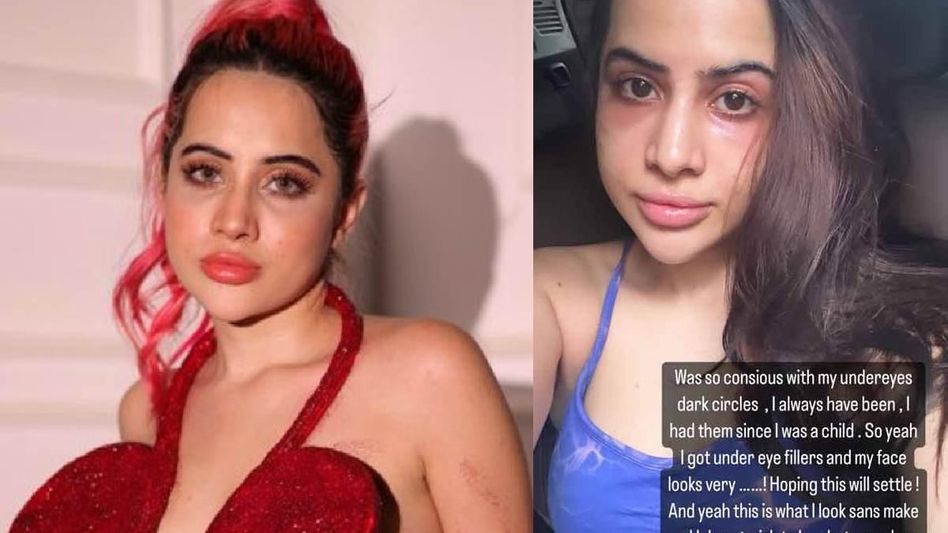 Uorfi Javed shows her bumpy eyes, warn fans against undereye filters Uorfi Javed shows her bumpy eyes, warn fans against undereye filters